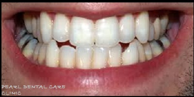 PEARL DENTAL CARE CLINIC | BEST DENTAL CARE IN ALIGARH-FAINS BAZAAZ